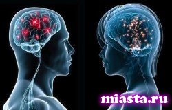 Ученые нашли новые различия в мозге мужчин и женщин