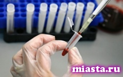 Ученые открыли новый агрессивный штамм вируса иммунодефицита человека