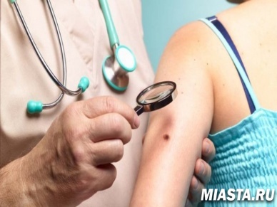 Тюменцев приглашают пройти обследование на рак кожи