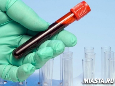 В Тюменском кардиоцентре 13 октября можно бесплатно проверить кровь на свертываемость.