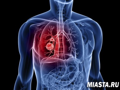 В тюменском Кардиоцентре запатентовали уникальный метод диагностики сосудов