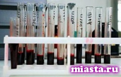 Академик Покровский: в ближайшем будущем вакцина от СПИДа не появится