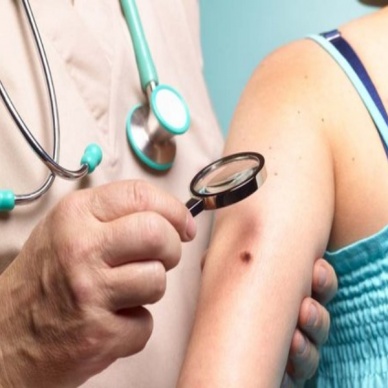 Тюменцев приглашают пройти обследование на рак кожи