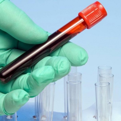 В Тюменском кардиоцентре 13 октября можно бесплатно проверить кровь на свертываемость.