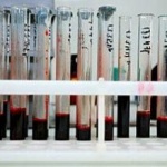 Академик Покровский: в ближайшем будущем вакцина от СПИДа не появится